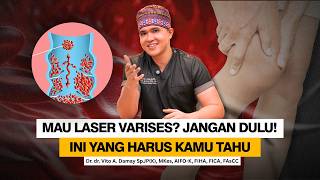 Dr. Vito | Don't Laser Varicose Veins Right Away! There's a Lot of Mistakes! Here's an Explanatio...