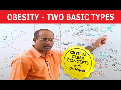 Obesity -Two basic types (Hypertrophic Obesity & Hypercellular Obesity/Hyperplastic Obesity)