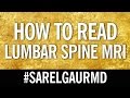 How To Read Lumbar Spine MRI:  Axial Anatomy