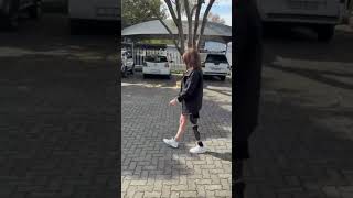 Her First Steps Again 🦿👍 Above-Knee Amputee Walks with Prosthetic Leg for the First Time #limbloss