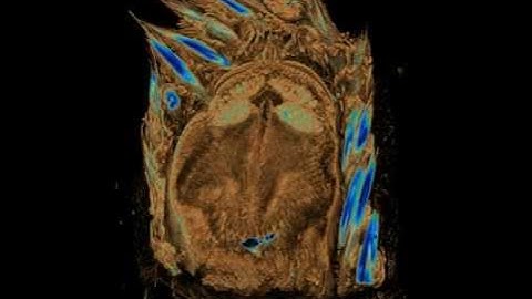 Micro-CT scan of Hermodice carunculata (Polychaeta, Amphinomidae)