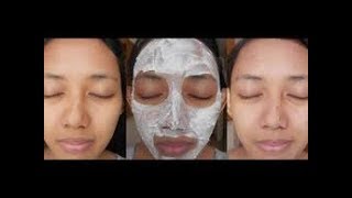 Luar Biasa Inilah 20 Manfaat Bedak Dingin Untuk Wajah Berjerawat Dan Berminyak