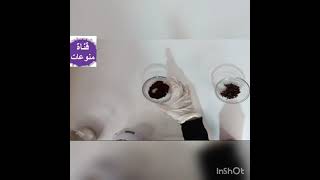 كل ما يجب معرفته عن القرنفل وفوائده