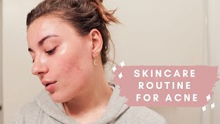 ACNE & CLOGGED PORES SKINCARE ROUTINE FEB 2020 @EmilyFreybler