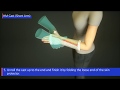 Hm cast short arm 3d procedure