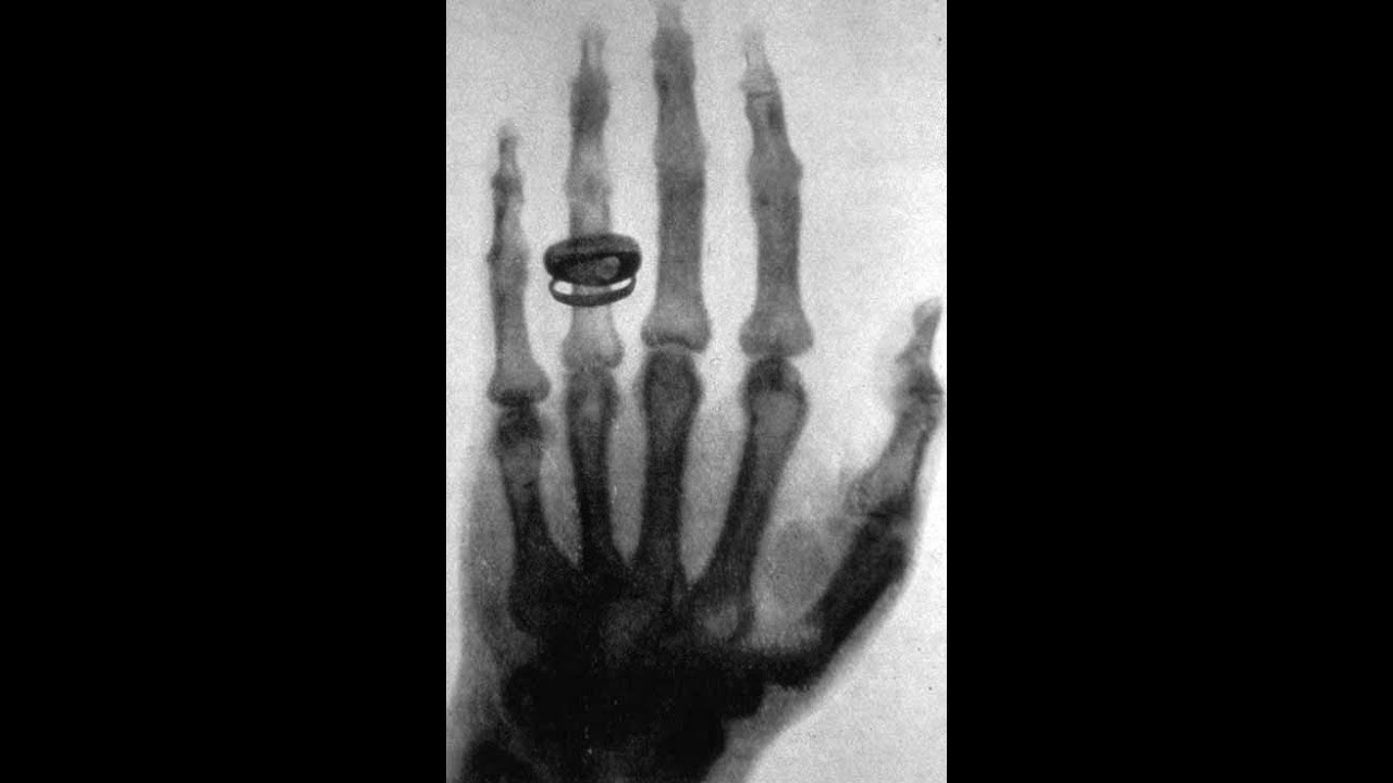 Deutschland-Genies-Forscher-Erfinder: Kapitel 54 b Teil 2 - Wilhelm Conrad Röntgen - Die Strahlen
