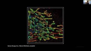 All-Optical Super-Resolution Imaging — Joerg Bewersdorf | Duke Engineering