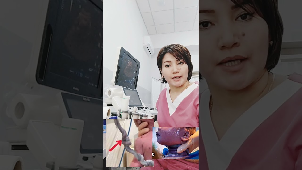 катта срокда 8 ойлик хомила она корнида нобуд булди