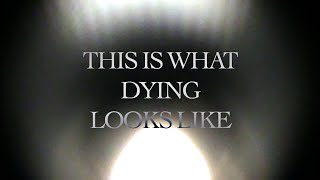 This Is What Dying Looks Like