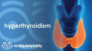 Nursing Care: Hyperthyroidism (Part 2) - Nursing Study Buddy Video Library