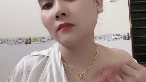 Cạo gió ngục Nana Công Chúa //BắtGio Vùng Cao Vlog