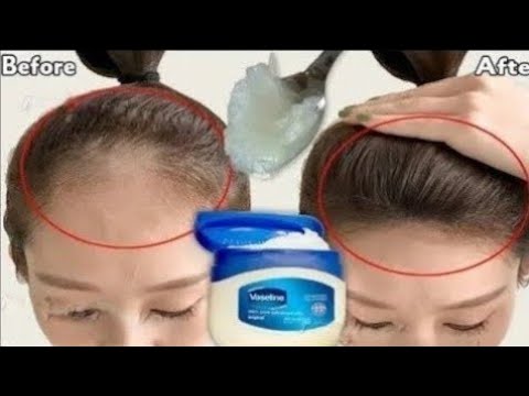 كيفية استخدام الفازلين ‼️هيخلي شعرك زي الباروكة ‼️ يزيل الصلع وتساقط الشعر  thumbnail