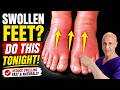 Swollen Feet? DO THIS Tonight! Dr. Mandell