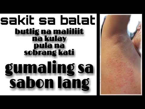 Video: Winter Ambulansya Para Sa Iyong Balat