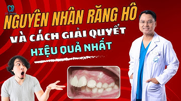 NGUYÊN NHÂN RĂNG HÔ Và Cách Giải Quyết HIỆU QUẢ NHẤT | Dr Cường Official