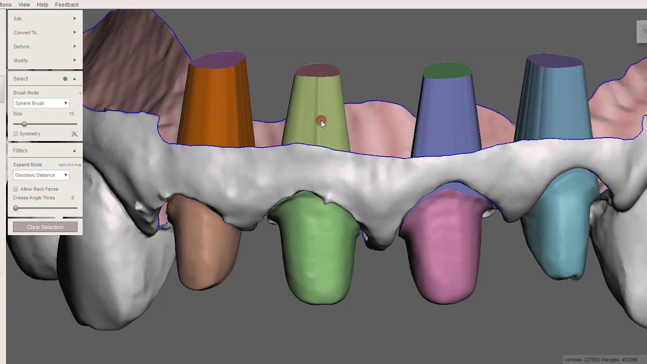 Meshmixer - Multi-tooth Geller Model