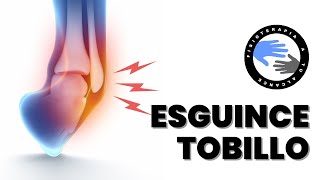 Tobillo hinchazón de esguince e