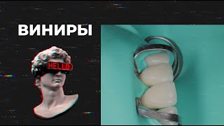 видео: ВИНИРЫ картинка: ВИНИРЫ