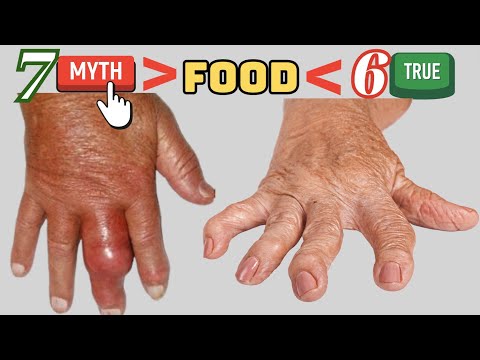 Rheumatoid Arthritis : 7 Myths and 6 fact  Food