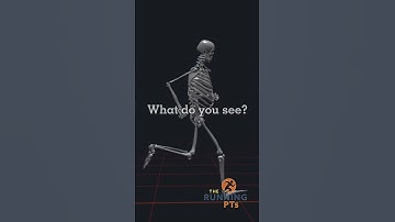 3D Gait Analysis Skeleton Model