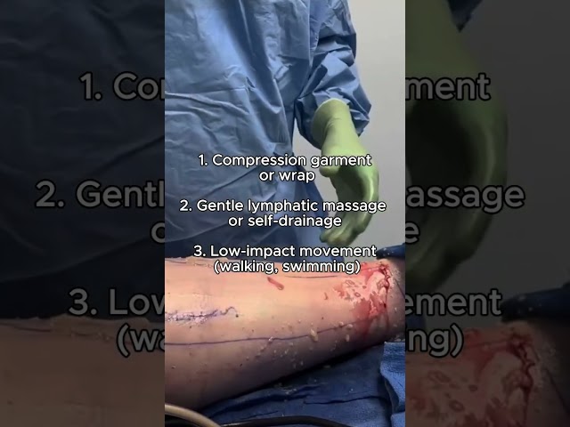 Lipedema relief isn’t about quick fixes — it’s about consistency