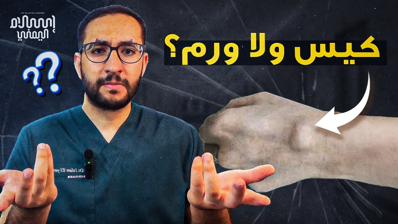 الكيس الزلالي | أسبابه وطرق علاجه