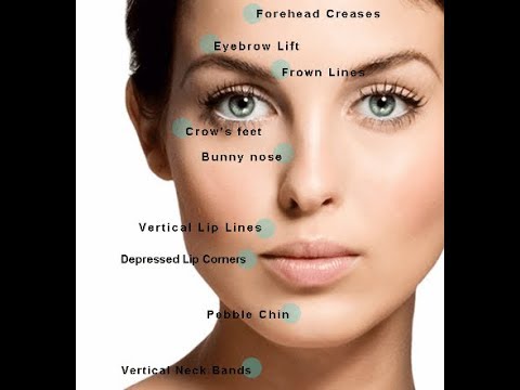 How To Remove Dark Spots Around Mouth How To Get Rid Of Dark Circles Around The Mouth Video Youtube