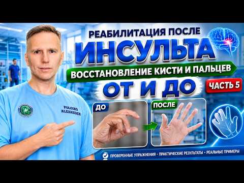 Восстановление движений в кисти и пальцах после инсульта, комплексный подход к проблеме!