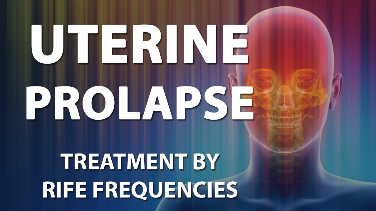 Uterine Prolapse - RIFE Frequencies Treatment - Energy & Quantum Medicine with Bioresonance