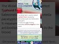 Widal Tube Agglutination Test | Typhoid Fever Diagnosis | Pathquest Diagnostics #pathologylab