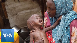 Children Dying in Somalia as Food Catastrophe Worsens