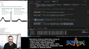 Enhancing ECG Waveform Analysis: Optimizing a Fuzzy Logic Algorithm