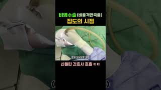 비염 수술 하는 의사 시점 #shorts