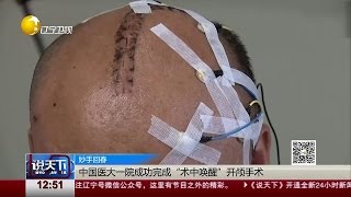 医生成功完成“术中唤醒”开颅术 边聊天边切瘤