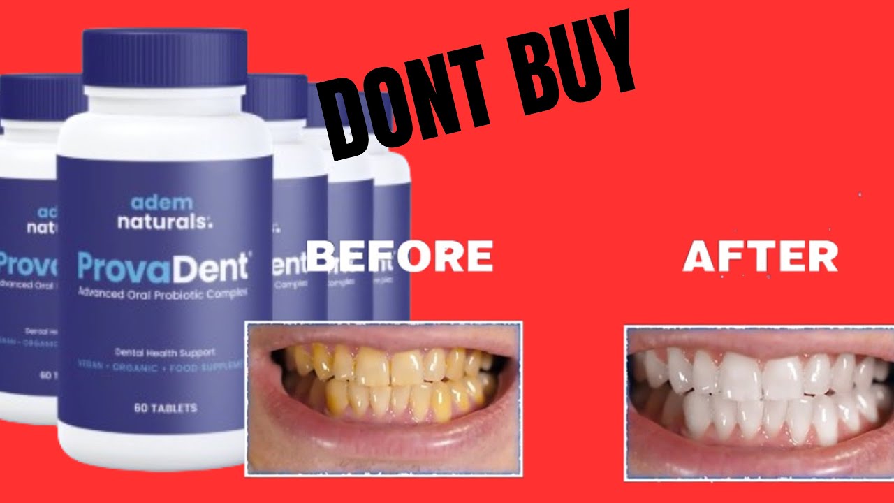 PROVADENT ✅🔥 DONT BUY! PROVADENT REVIEW PROVADENT INGREDIENTS PROVADENT ORAL PROBIOTIC