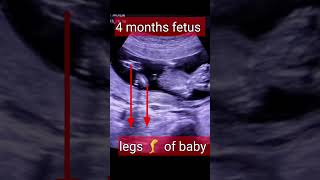 15 weeks baby in mother's womb / shortvideo/ short screenshot 4