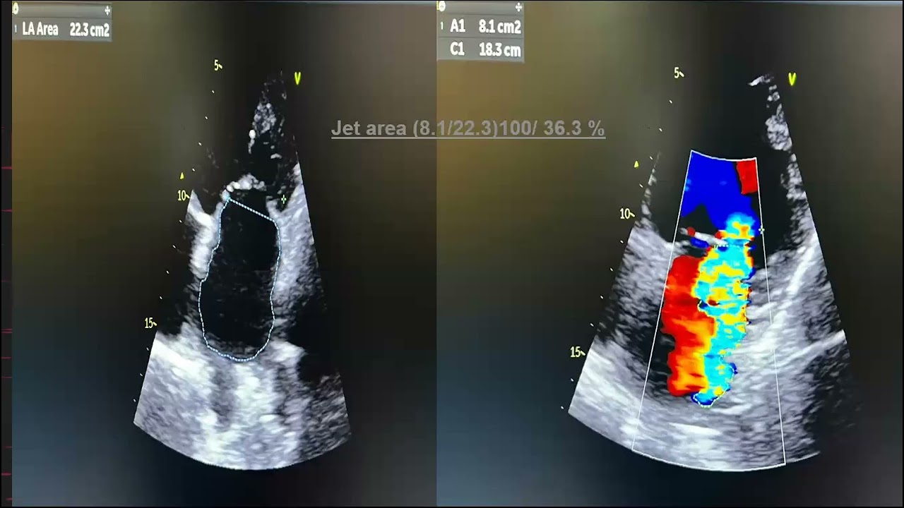Echo conference 29/11/2023 Dr.Hesham Tarek