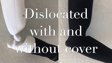 Elbow Dislocation Simulator | How to reduce a dislocated elbow | Patient face down technique