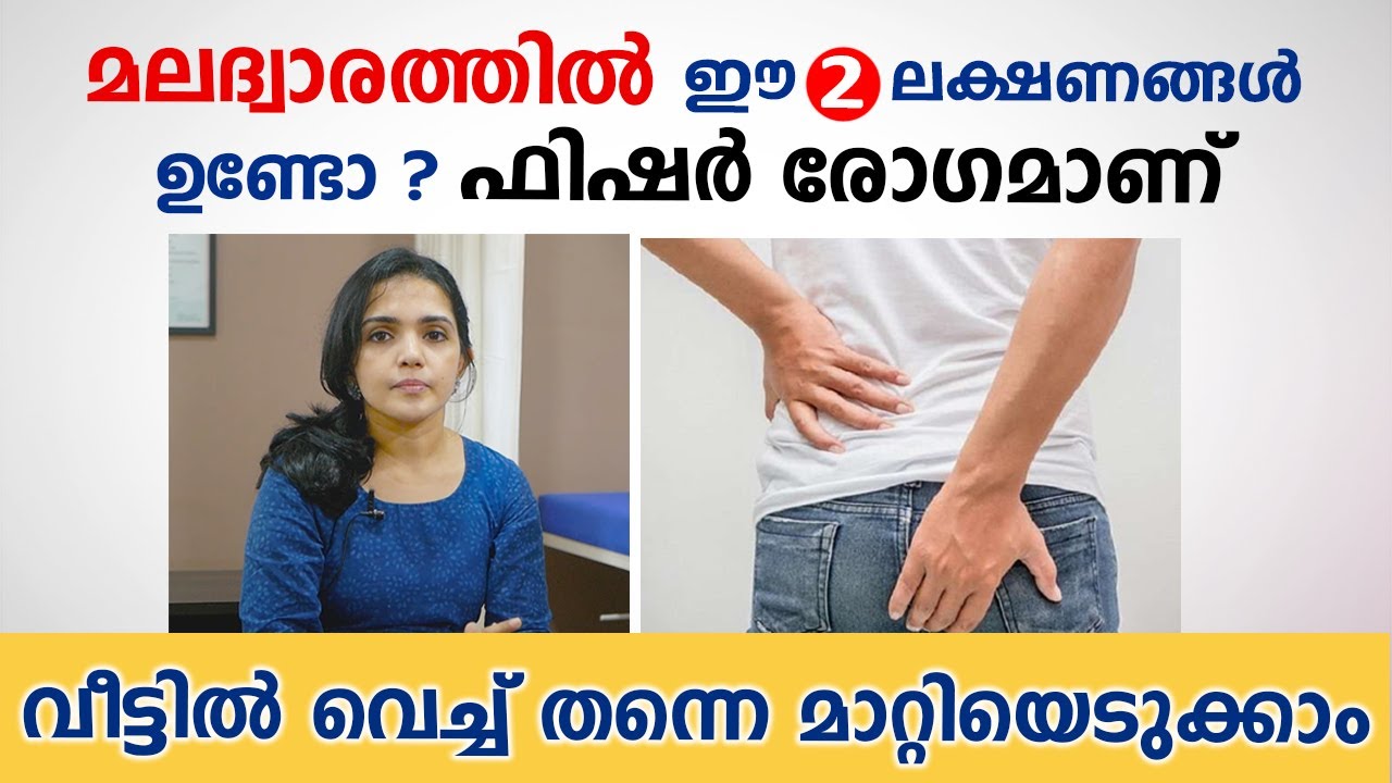 മലദ്വാരത്തിൽ ഈ 2 ലക്ഷണങ്ങൾ ഉണ്ടോ ഫിഷർ രോഗമാണ് | fissure home remedies | Arogyam