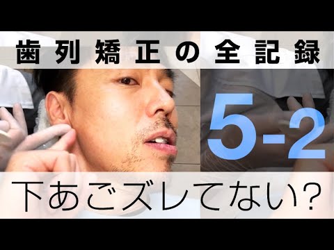 下顎 前 に 出す トレーニング