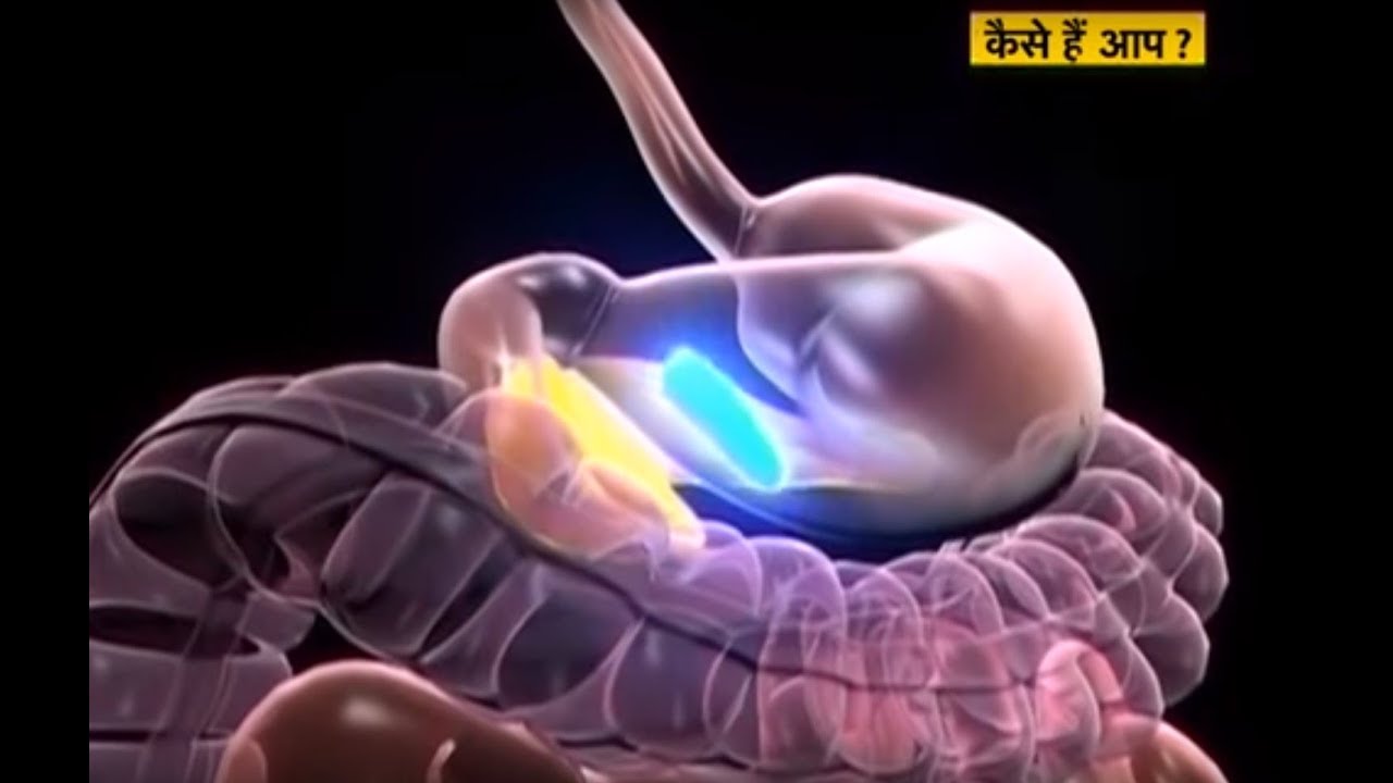 Kaise Hain Aap ? - Hiatus hernia special doordarshan logo