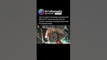 How Medivis AR is Transforming Surgery with Augmented Reality! #surgeryreview #medtechinnovation