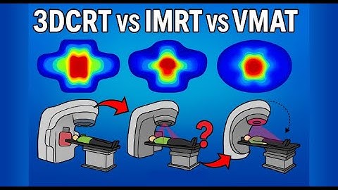 3D-CRT, IMRT, VMAT: The Must-Know Differences