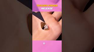 Trigger Finger Release Surgery | Tendon Release 3D Animation | Hand Surgery Explained #Doctor3D