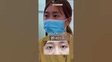 Một hành trình của hai chị em cùng cắt mí tại Dr.Hải Lê sẽ ra sao?