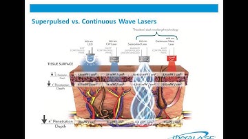 2012 03 27 13 03 Comparison of Class 3 vs Class 4 Lasers