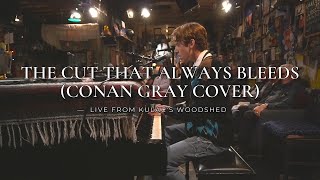 Download Lagu Dylan Yong - The Cut That Always Bleeds (Conan Gray Cover - Live From Kulac's Woodshed) MP3 Download Lagu Dylan Yong - The Cut That Always Bleeds (Conan Gray Cover - Live From Kulac's Woodshed) MP3