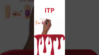 (Immune Thrombocytopenic Purpura)ITP ايه هى ال