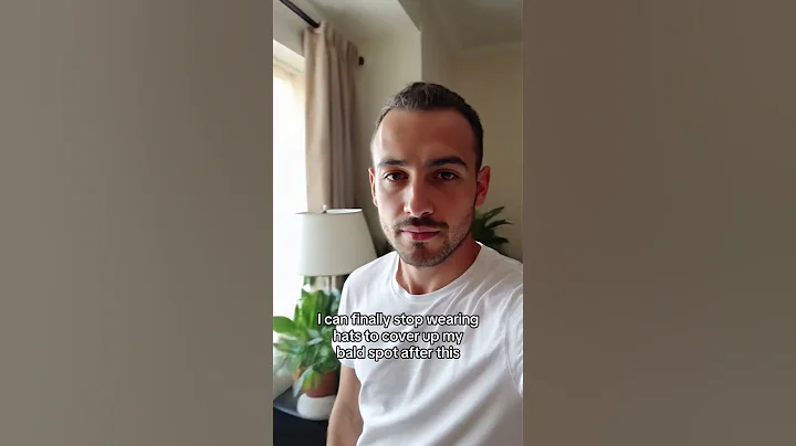 I can finally stop wearing hats to cover up my bald spot after this