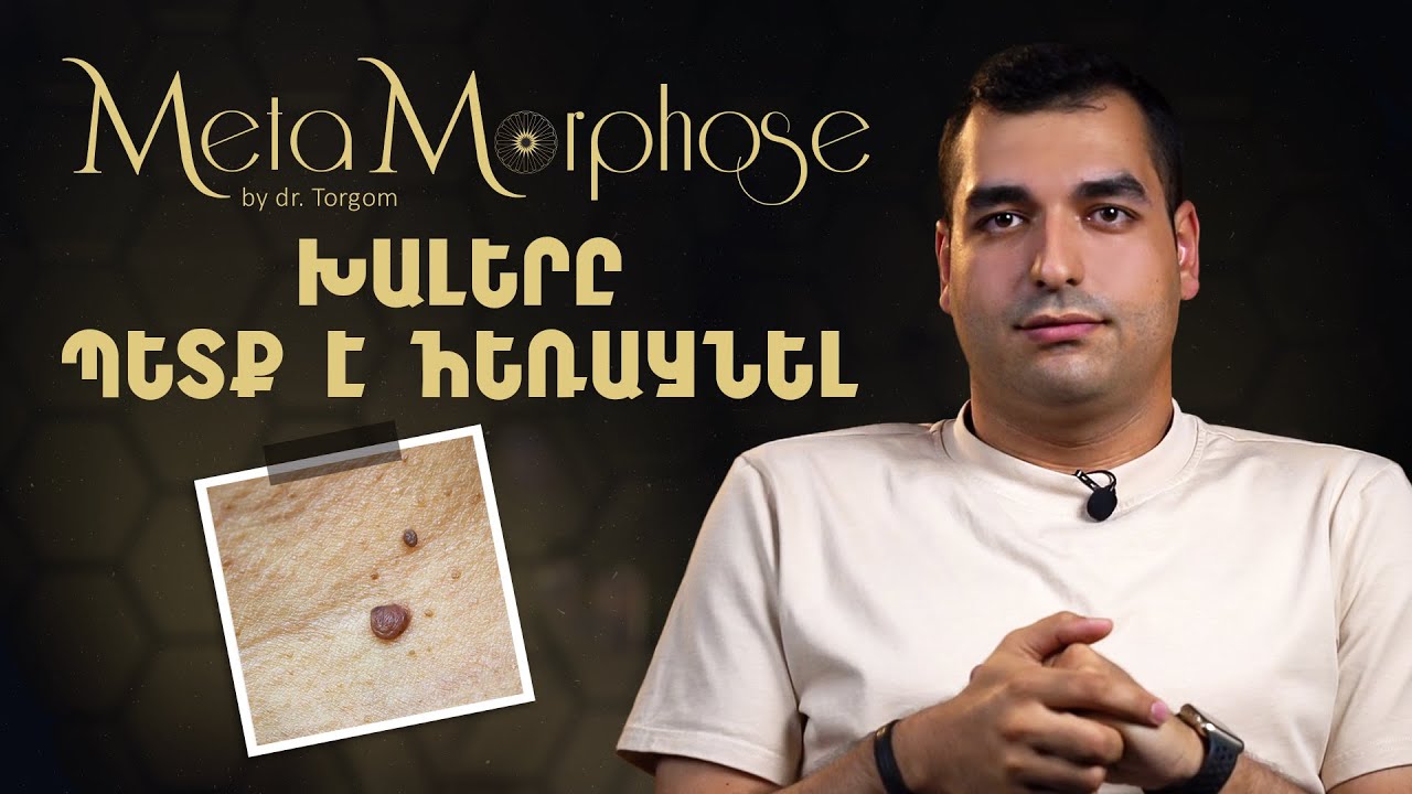 Նորագոյացություններ․ խալեր | MetaMorphose 04